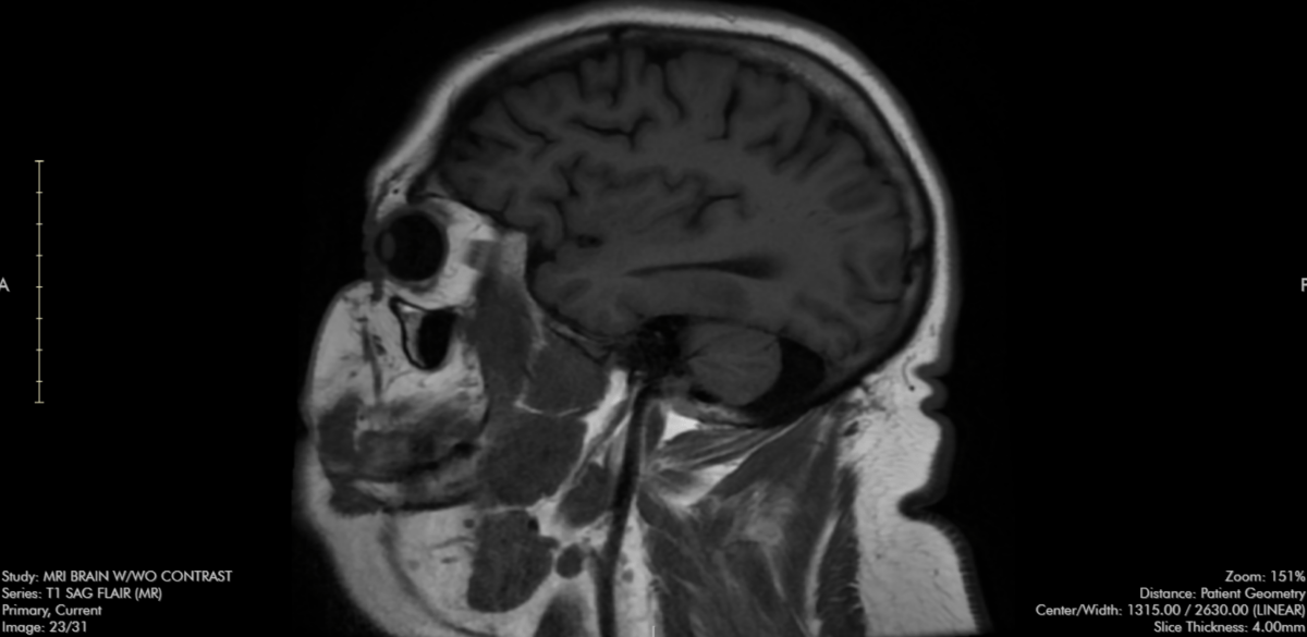 Back to the Drawing&nbsp;Board